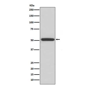 ERp57 (7K11)兔单抗,ERp57 (7K11) Rabbit Monoclonal Antibody