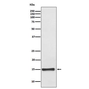 FABP4 (8A13)兔单抗,FABP4 (8A13) Rabbit Monoclonal Antibody