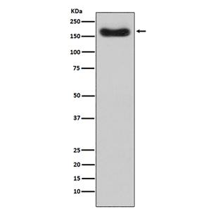 Factor H (19Y10)兔单抗,Factor H (19Y10) Rabbit Monoclonal Antibody