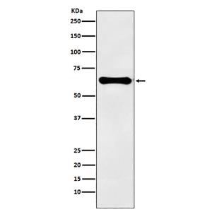 Factor IX  (1L7)兔单抗,Factor IX  (1L7) Rabbit Monoclonal Antibody