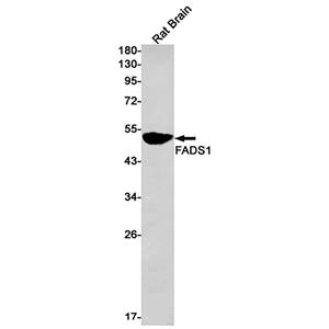 FADS1 (6Q19)兔单抗,FADS1 (6Q19) Rabbit Monoclonal Antibody