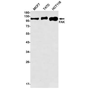 FAK (14V18)兔单抗,FAK (14V18) Rabbit Monoclonal Antibody