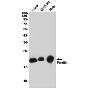 Ferritin (18K15)兔单抗,Ferritin (18K15) Rabbit Monoclonal Antibody