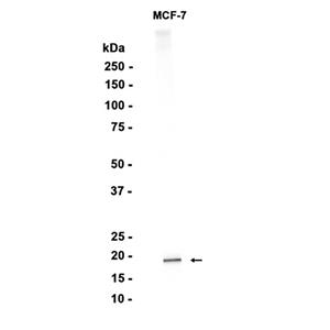 Ferritin Light Chain (10S14)兔单抗,Ferritin Light Chain (10S14) Rabbit Monoclonal Antibody