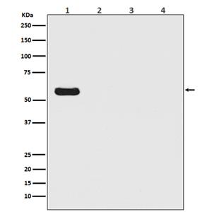 Firefly Luciferase (13Z19)兔单抗,Firefly Luciferase (13Z19) Rabbit Monoclonal Antibody
