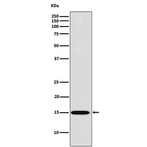 Galectin 7 (11B9)兔单抗,Galectin 7 (11B9) Rabbit Monoclonal Antibody