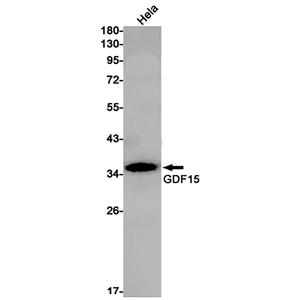 GDF15 (6F3)兔单抗,GDF15 (6F3) Rabbit Monoclonal Antibody