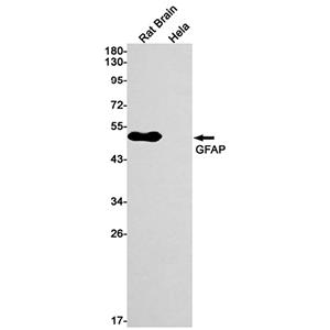 GFAP  (18L1)兔单抗,GFAP  (18L1) Rabbit Monoclonal Antibody