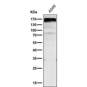 Gli1 (17P5)兔单抗,Gli1 (17P5) Rabbit Monoclonal Antibody