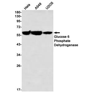 Glucose 6 Phosphate Dehydrogenase (5Y1)兔单抗,Glucose 6 Phosphate Dehydrogenase (5Y1) Rabbit Monoclonal Antibody
