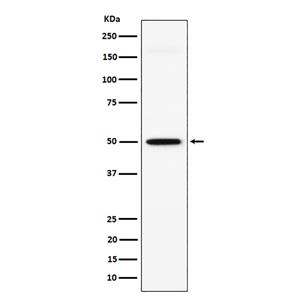 GPA33 (3I9)兔单抗,GPA33 (3I9) Rabbit Monoclonal Antibody