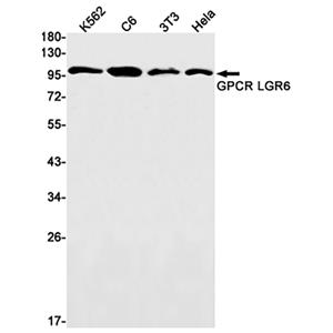 GPCR / LGR6 (5S15)兔单抗,GPCR / LGR6 (5S15) Rabbit Monoclonal Antibody