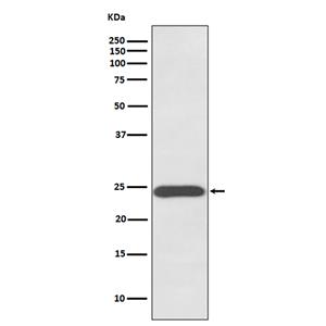 Growth Hormone (12Z11)兔单抗,Growth Hormone (12Z11) Rabbit Monoclonal Antibody