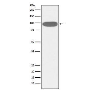 GRP94 (2K1)兔单抗,GRP94 (2K1) Rabbit Monoclonal Antibody