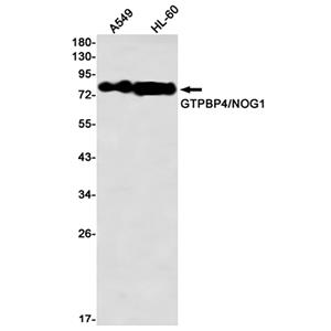 GTPBP4 (14J8)兔单抗,GTPBP4 (14J8) Rabbit Monoclonal Antibody