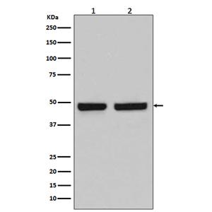HAPLN1  (8N5)兔单抗,HAPLN1  (8N5) Rabbit Monoclonal Antibody