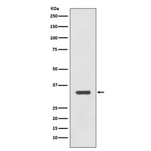HLA-DRA (4K6)兔单抗,HLA-DRA (4K6) Rabbit Monoclonal Antibody