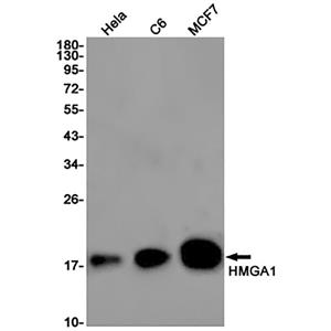 HMGA1 (13B3)兔单抗,HMGA1 (13B3) Rabbit Monoclonal Antibody