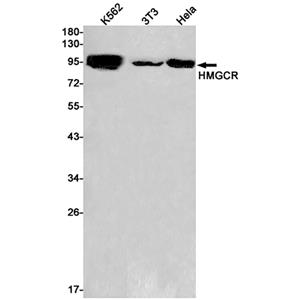 HMGCR (10J19)兔单抗,HMGCR (10J19) Rabbit Monoclonal Antibody