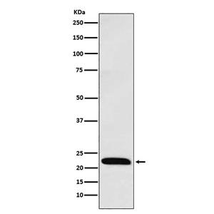 ICOS (16D3)兔单抗,ICOS (16D3) Rabbit Monoclonal Antibody