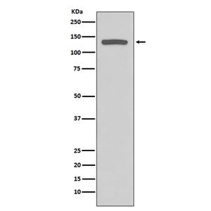 iNOS (12H16)兔单抗,iNOS (12H16) Rabbit Monoclonal Antibody