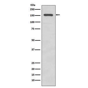 Integrin alpha 2 (19O18)兔单抗,Integrin alpha 2 (19O18) Rabbit Monoclonal Antibody