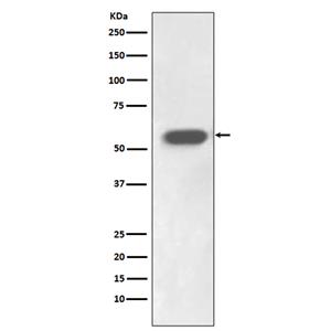 IRF7 (1D12)兔单抗,IRF7 (1D12) Rabbit Monoclonal Antibody
