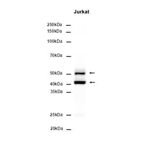 JNK (19C18)兔单抗,JNK (19C18) Rabbit Monoclonal Antibody