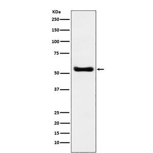 KAT8 / MYST1 / MOF (9E16)兔单抗,KAT8 / MYST1 / MOF (9E16) Rabbit Monoclonal Antibody