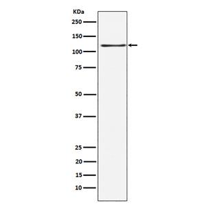KSR1 (5X11)兔单抗,KSR1 (5X11) Rabbit Monoclonal Antibody