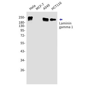 Laminin gamma 1 (9A17)兔单抗,Laminin gamma 1 (9A17) Rabbit Monoclonal Antibody