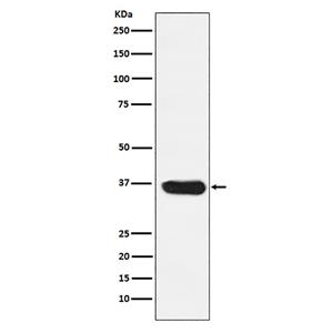 LDHA (4H19)兔单抗,LDHA (4H19) Rabbit Monoclonal Antibody