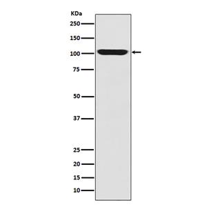 LGR5/GPR49 (2F16)兔单抗,LGR5/GPR49 (2F16) Rabbit Monoclonal Antibody