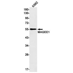 MAGEC2 (3A19)兔单抗,MAGEC2 (3A19) Rabbit Monoclonal Antibody