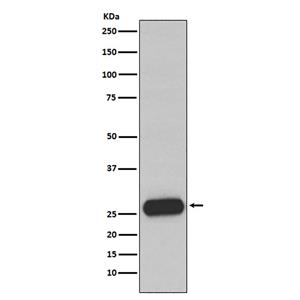 Mast Cell Chymase (13J16) Rabbit Monoclonal Antibody | 兔单抗 | EnkiLife恩玑生命