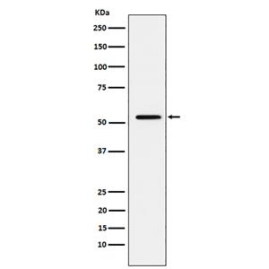 MMP1 (7T4)兔单抗,MMP1 (7T4) Rabbit Monoclonal Antibody