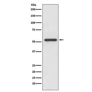 MMP13 (15M12)兔单抗,MMP13 (15M12) Rabbit Monoclonal Antibody