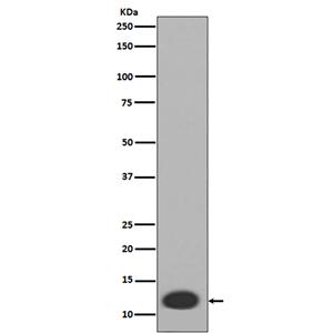 MRP8 (16L5)兔单抗,MRP8 (16L5) Rabbit Monoclonal Antibody