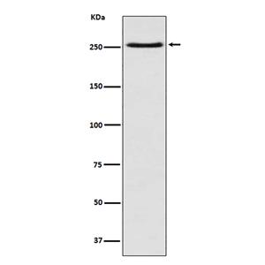 mTOR (1L6)兔单抗,mTOR (1L6) Rabbit Monoclonal Antibody
