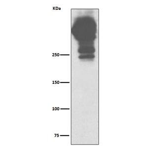 MUC5AC (10H12)兔单抗,MUC5AC (10H12) Rabbit Monoclonal Antibody