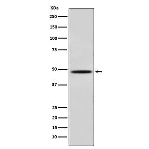 MyoD (5R13)兔单抗,MyoD (5R13) Rabbit Monoclonal Antibody