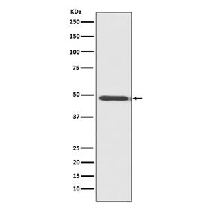 MyoD1 (5M4)兔单抗,MyoD1 (5M4) Rabbit Monoclonal Antibody
