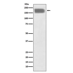 NCAM (6H4)兔单抗,NCAM (6H4) Rabbit Monoclonal Antibody