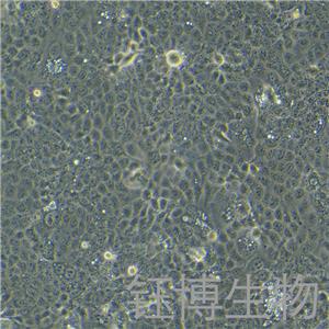 OE-33（人食管腺癌细胞）YB-71821HC