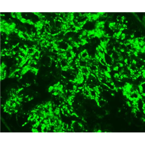 鼠乳腺癌成纤维细胞,Mouse breast cancer fibroblasts