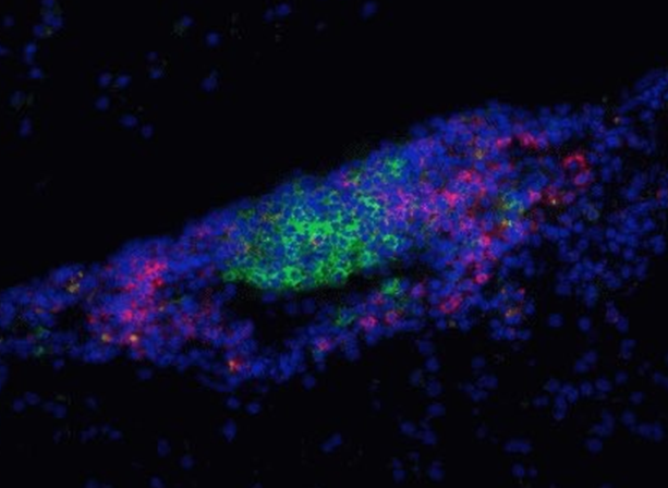 小鼠肺微血管平滑肌细胞,Mouse pulmonary microvascular smooth muscle cells