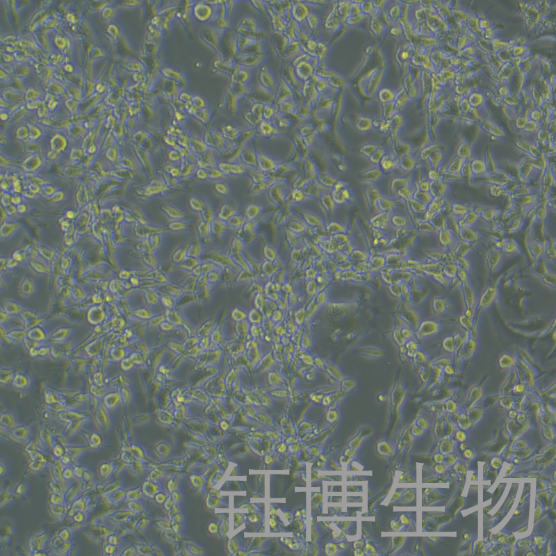 STC-1（小鼠小肠内分泌细胞系）YB-7042MC,STC-1