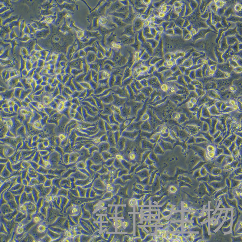 DMS-114（人小细胞肺癌细胞）YB-71835HC,DMS-114