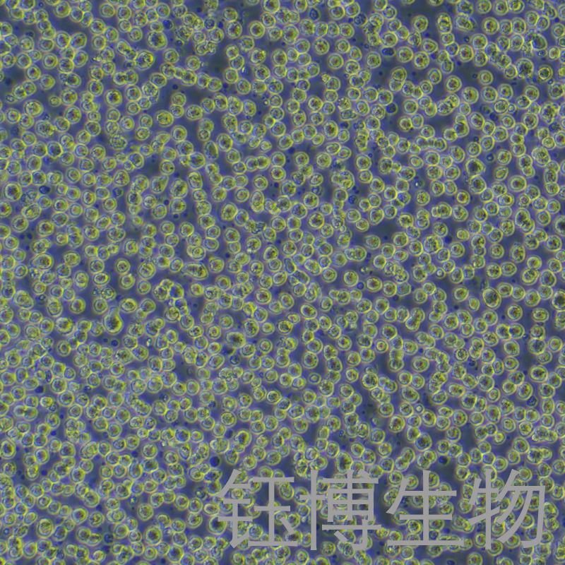 Karpas-299（人间变性大细胞淋巴瘤细胞）YB-71839HC,Karpas-299