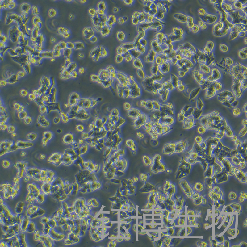 LS1034（人结肠腺癌细胞）YB-71842HC,LS1034